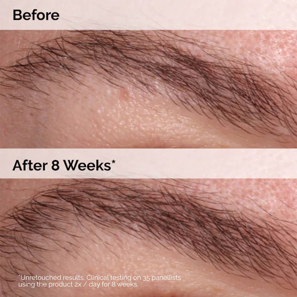 The Ordinary Multi Peptide Lash and Brow Serum